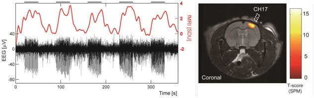 EEGとfMRIの同時計測結果