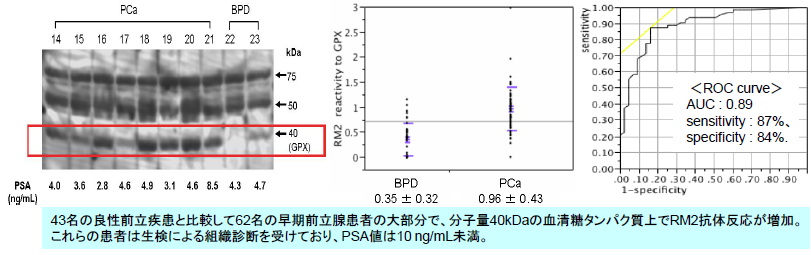 泌尿生殖器系癌の診断方法