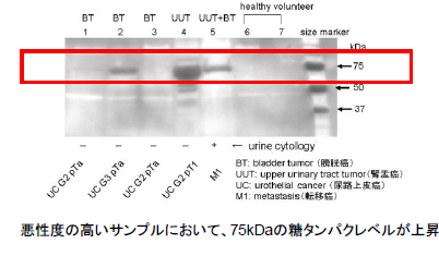 泌尿生殖器系癌の診断方法