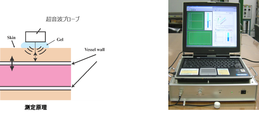 動脈硬化・動脈瘤の診断装置