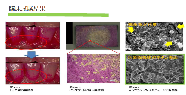 キャビテーションを利用した口腔洗浄装置