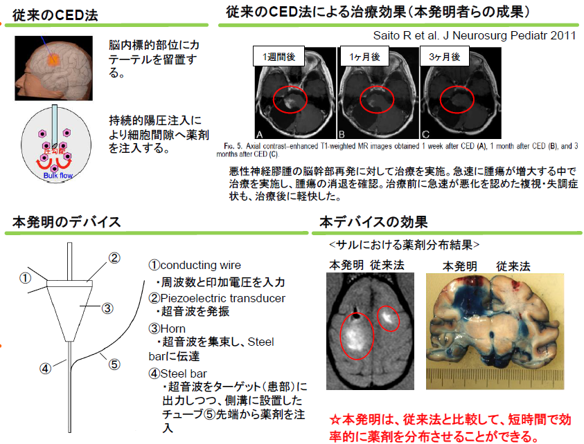 超音波併用薬剤送達システム