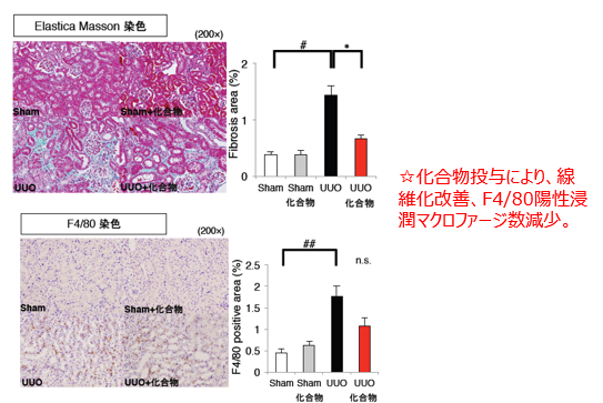 臓器線維化抑制剤