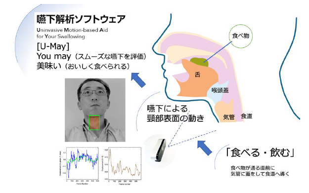 食べ物を飲み込む運動の非接触的定量診断装置