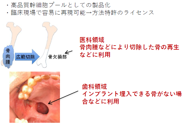振盪浮遊培養を用いた間葉系幹細胞の未分化性維持法