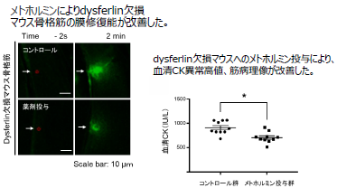 筋ジストロフィーの治療薬候補
