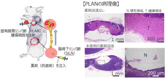 リンパ行性薬剤送達