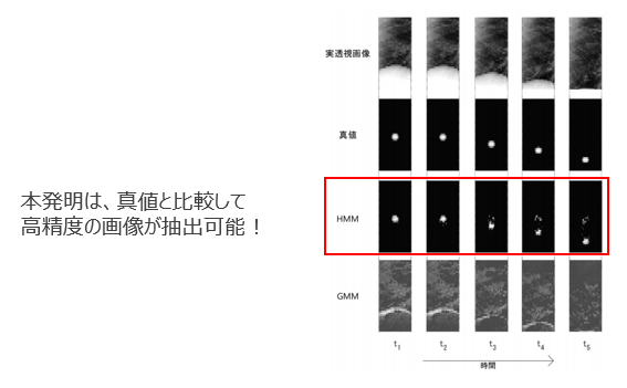 X線画像解析を用いた対象（軟部組織）追跡技術