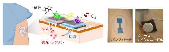 貼る注射「マイクロニードルポンプ」