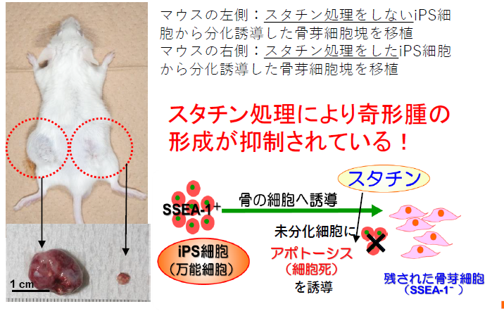 IPS細胞の腫瘍化を抑制することが可能な骨分化誘導方法