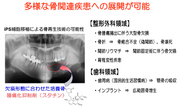 IPS細胞の腫瘍化を抑制することが可能な骨分化誘導方法