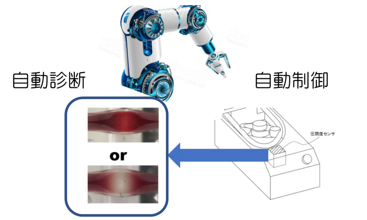 体外循環装置用　圧閉度処理装置