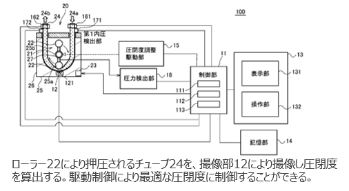 体外循環装置用　圧閉度処理装置