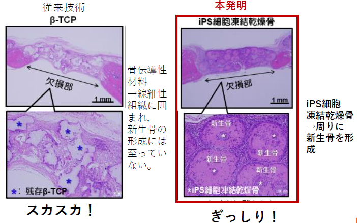 骨誘導能を有する吸収置換型骨再生剤