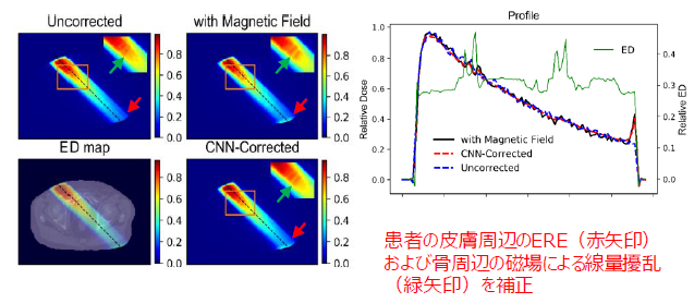 深層学習を用いた磁場下の高速線量計算アルゴリズム