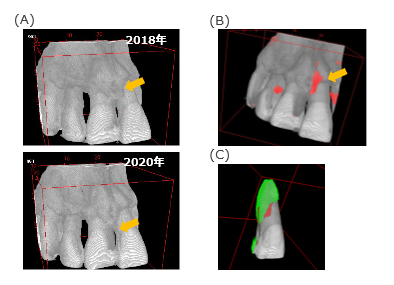 三次元画像処理プログラム