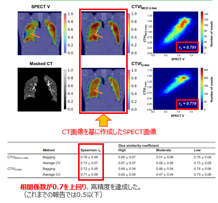 肺機能の予測方法