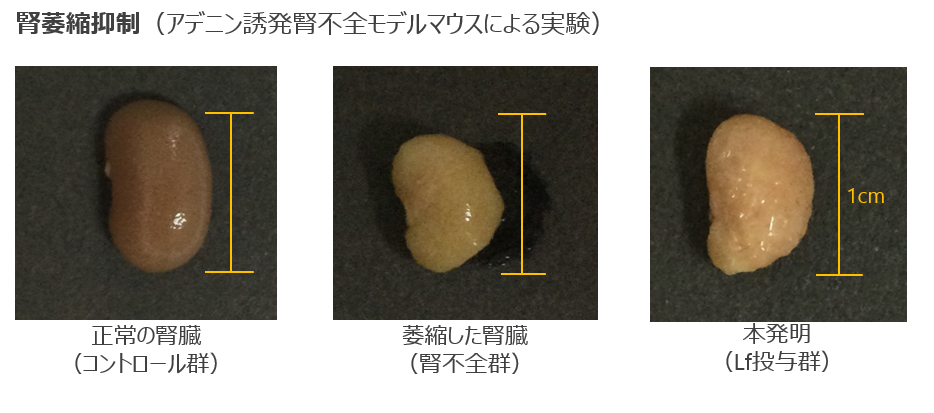 慢性腎臓病合併症の治療・予防剤