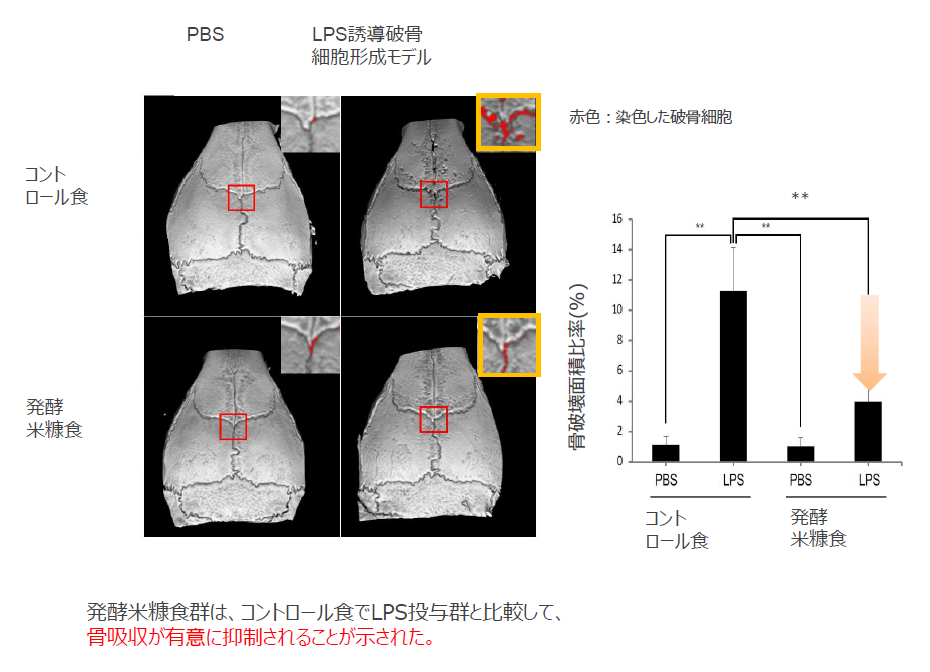 骨吸収の抑制剤