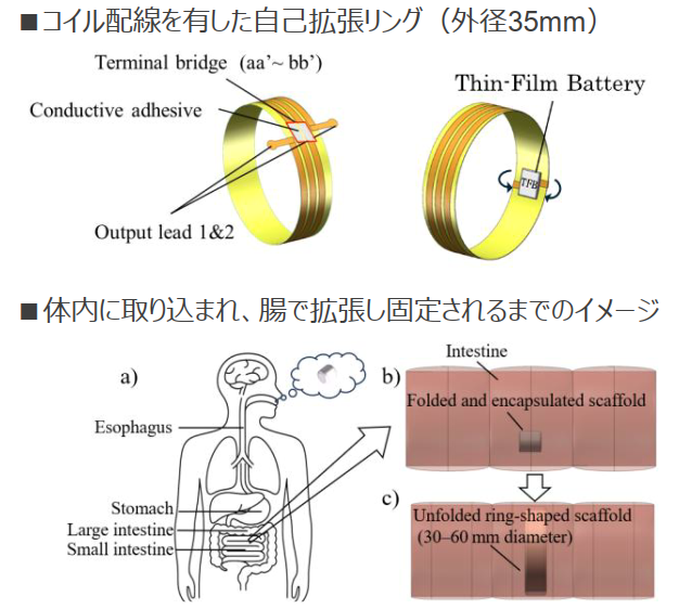 飲み込み型デバイス